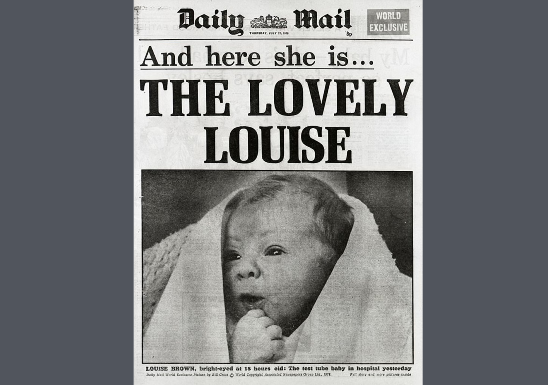 July 25, 1978 - The world's first test-tube baby was born